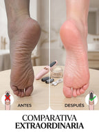PediGlow™ - Pedicura Profesional en Casa